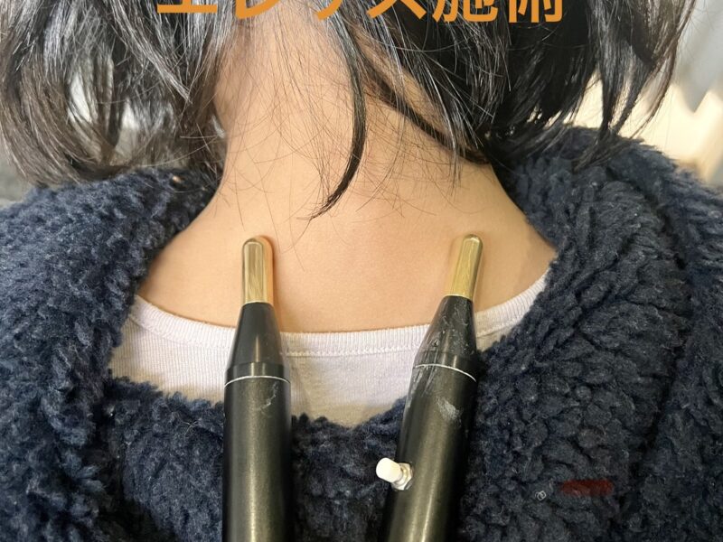 【症例紹介】10代・朝起きたら首が痛く上を向けない